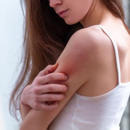 What Is the Effect of Psoriasis on One’s Sexual Health?